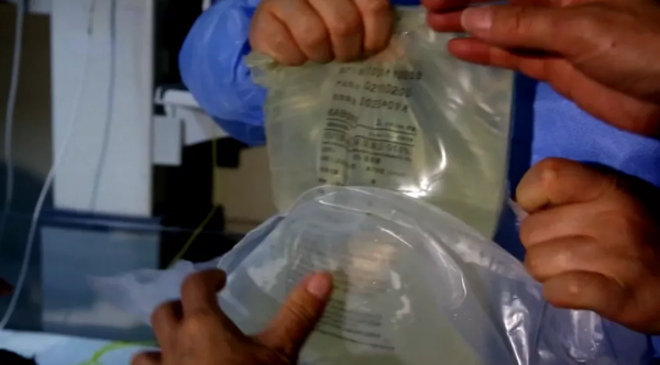 體重僅1.72公斤！呼吸窘迫、急性腎衰、心臟驟停！31周早產兒的“生命闖關”