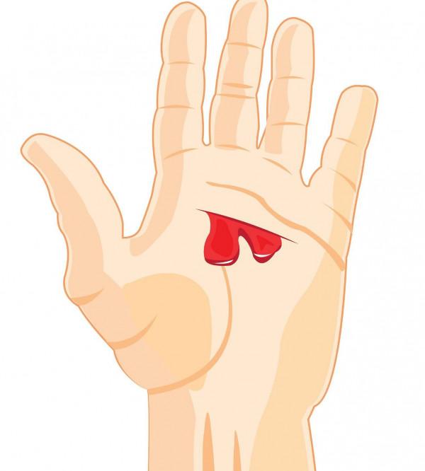 “白血病”專挑孩子下手，家長注意：孩子有5個異常，需及時排查