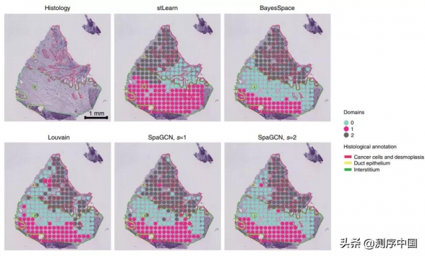 Nat Methods | 李明瑤團隊發表空間轉錄組資料分析的新演算法SpaGCN Nat Methods | 李明瑤團隊發表空間轉錄組資料分析的新演算法SpaGCN