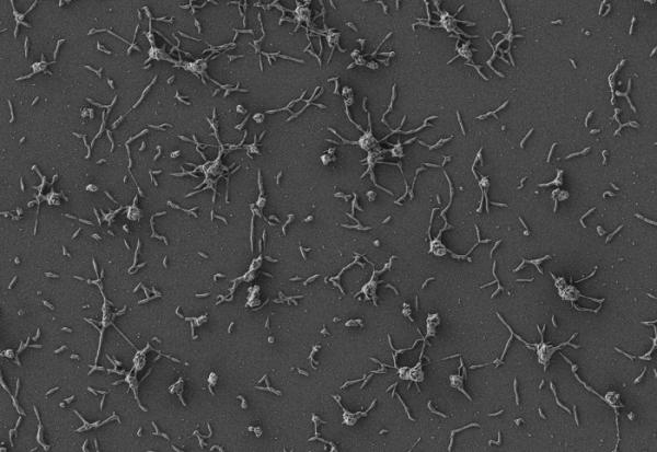 科學家嘗試用微生物“活體療法”應對超級細菌感染