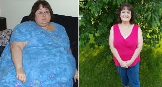 53歲的她體重直飆400斤,胖到不能走路!減肥是健康的唯一出路 53歲的她體重直飆400斤,胖到不能走路!減肥是健康的唯一出路