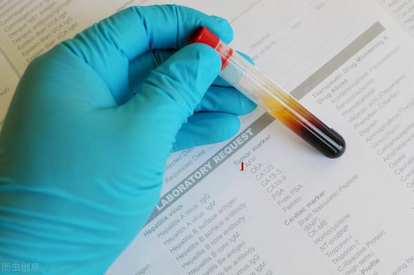 「腫瘤標誌物」高就是肺癌嗎?醫生:肺癌主要看5個指標 「腫瘤標誌物」高就是肺癌嗎?醫生:肺癌主要看5個指標