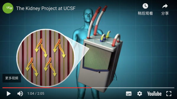人造器官上新！首個植入式人工腎有望使數百萬人擺脫透析和腎移植