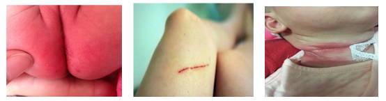 嬰兒餵養事件記錄（一）