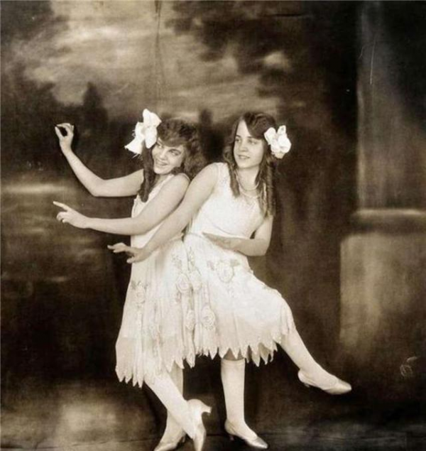 連體人一方去世怎麼辦？連體妹妹死亡後，姐姐被迫和遺骸生存2天