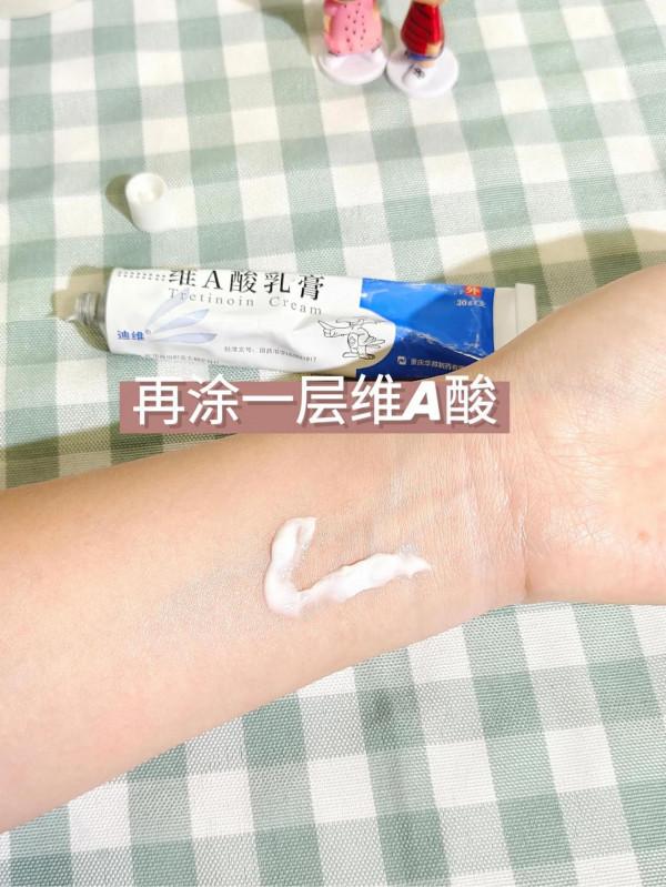 淡法令紋還有小技巧？用倆月紋淺了