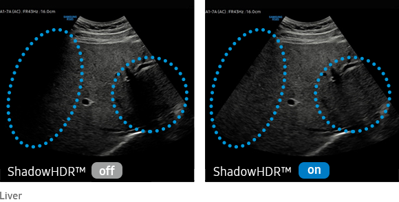 三星醫療高階超聲診斷系統&mdash;&mdash;RS85 Prestige