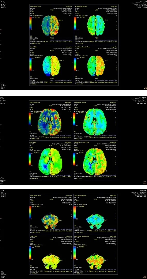 顛覆臨床醫生思維的檢查 顛覆臨床醫生思維的檢查