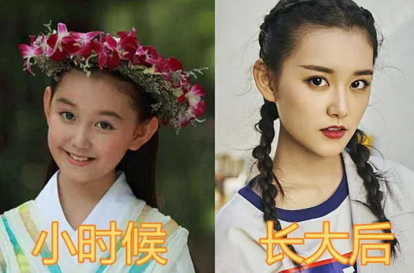 被禁止整容的5位童星，小時候精緻惹眼，步入青春期後各有千秋