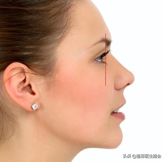 眉弓——讓你變“混血”的點睛之筆? 眉弓——讓你變“混血”的點睛之筆?