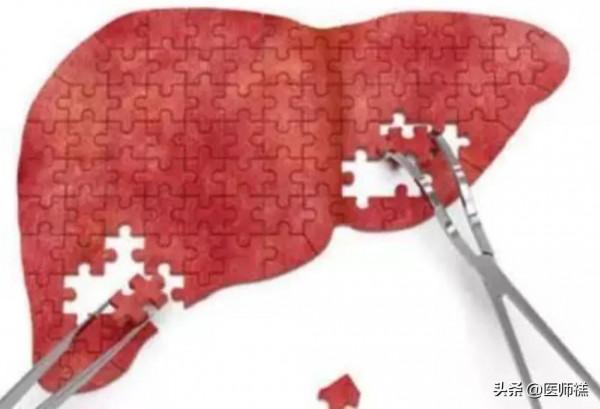 如果您正在服用阿託伐他汀，醫生提示，這些內容值得一讀