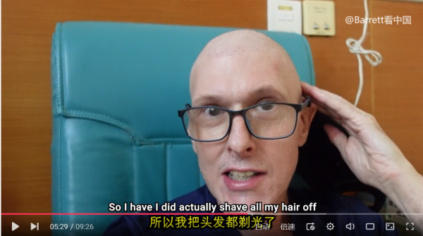 在中國治乳腺癌的博主巴瑞特公開化療情況:精神樂觀,頭髮都掉了 在中國治乳腺癌的博主巴瑞特公開化療情況:精神樂觀,頭髮都掉了