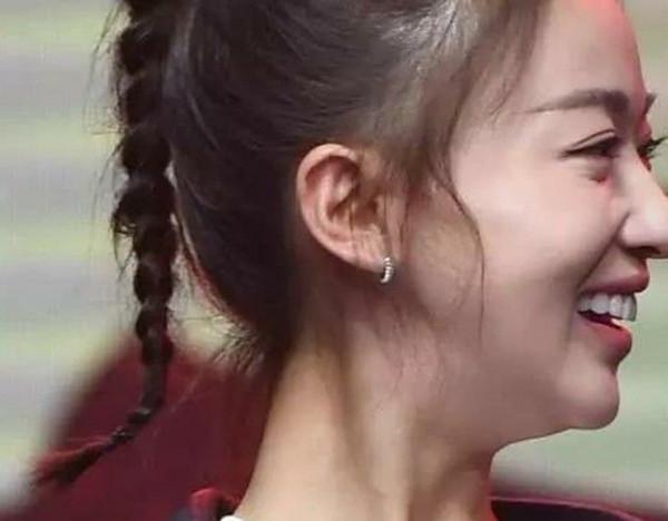 那些一刀切削骨的明星還好嗎?後遺症一大堆,小方臉成最大贏家 那些一刀切削骨的明星還好嗎?後遺症一大堆,小方臉成最大贏家