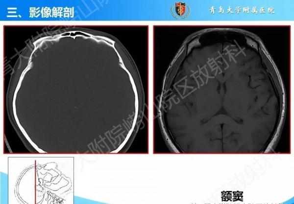 頭頸五官CT斷層解剖圖及常見病影像診斷