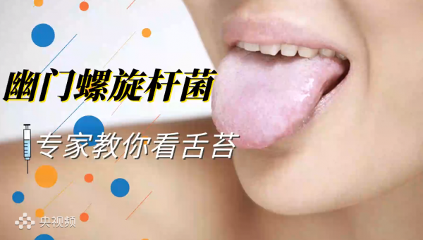 警惕！舌苔黃膩或是感染幽門螺旋桿菌