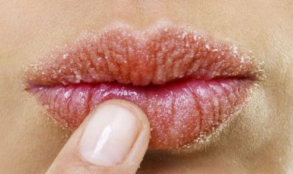 “脾開竅於口，其華在唇”從寶寶唇齒辨別身體狀況