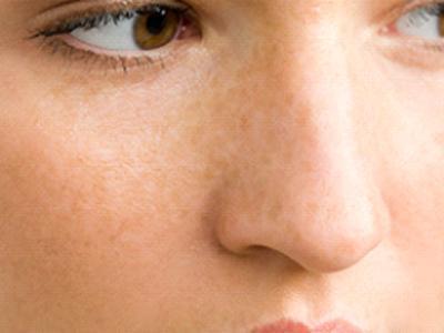 養顏與瀉下類中藥合理應用