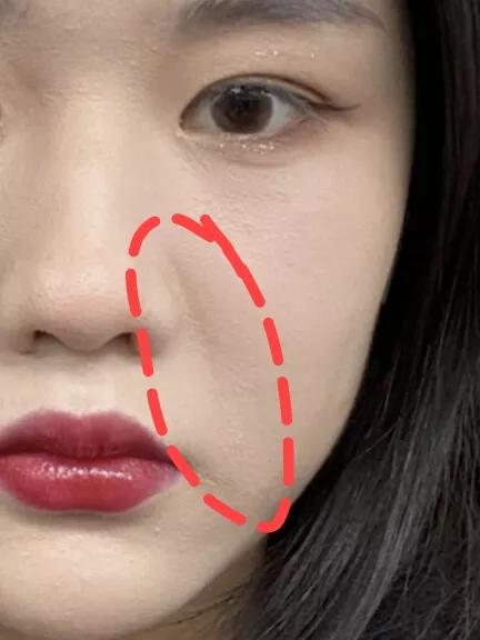 牢記這幾個點！淡化法令紋原來這麼簡單！長記性了