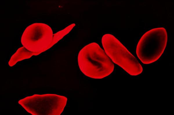 “退燒神藥”安乃近，為何被多國禁用？醫生：足以讓人喪命