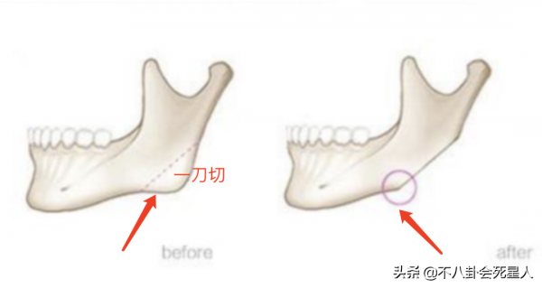 那些削骨的女星臉還好嗎？後遺症一大堆，楊冪鞠婧禕都開始崩了