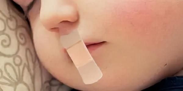 娃睡覺張嘴越長越醜？很多小孩都有的腺樣體肥大，一文說清