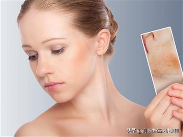 血糖失控面板瞞不住？醫生告訴你，面板若有3種表現你該控糖了