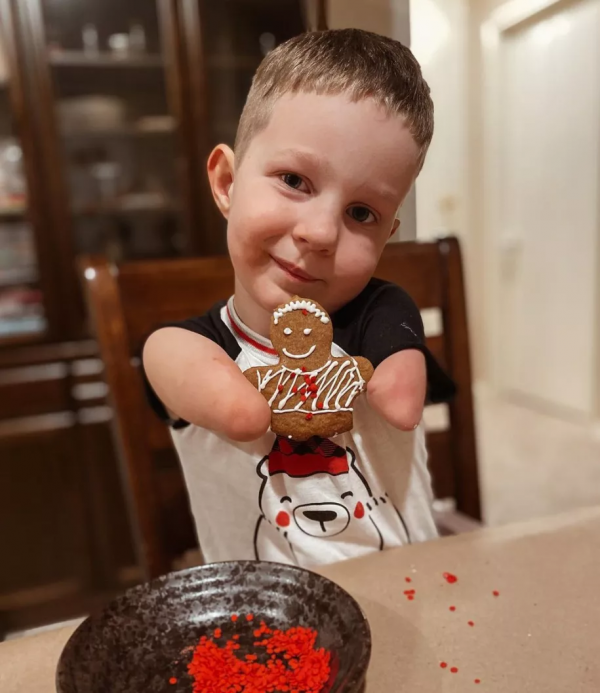 B超嬰兒無四肢,18歲媽媽拒絕墮胎,冒險生子,把孩子養成男子漢 B超嬰兒無四肢,18歲媽媽拒絕墮胎,冒險生子,把孩子養成男子漢