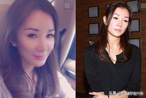 一直覺得金巧巧哪裡怪怪的，原來是沒有人中