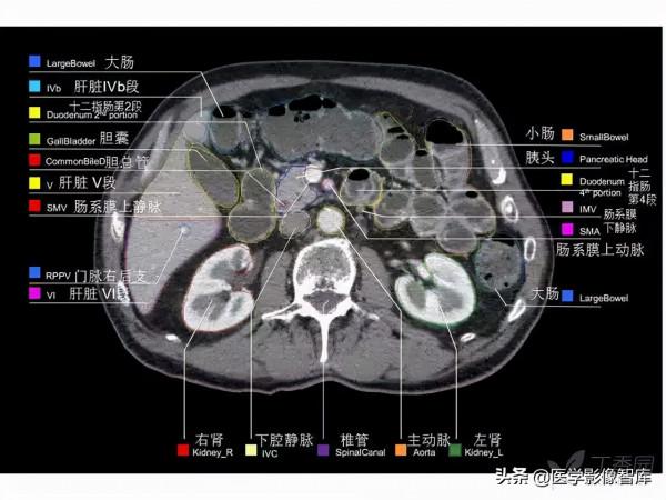 CT斷層解剖圖譜最全總結「推薦收藏」 CT斷層解剖圖譜最全總結「推薦收藏」