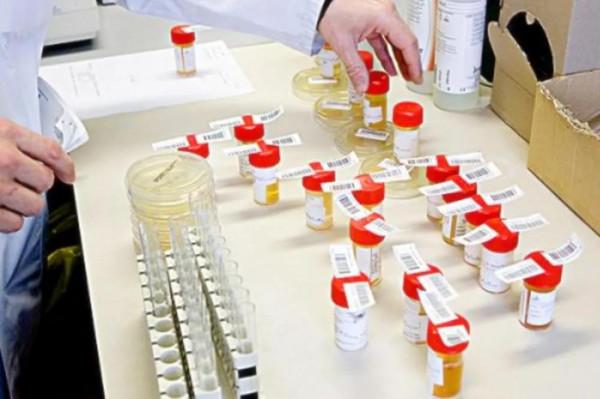 大千世界,無奇不有,有人高價回收孕婦尿,這有什麼用? 大千世界,無奇不有,有人高價回收孕婦尿,這有什麼用?