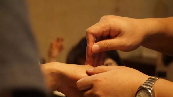 中醫針灸不傳之秘燒山火、透天涼究竟該如何操作? 中醫針灸不傳之秘燒山火、透天涼究竟該如何操作?