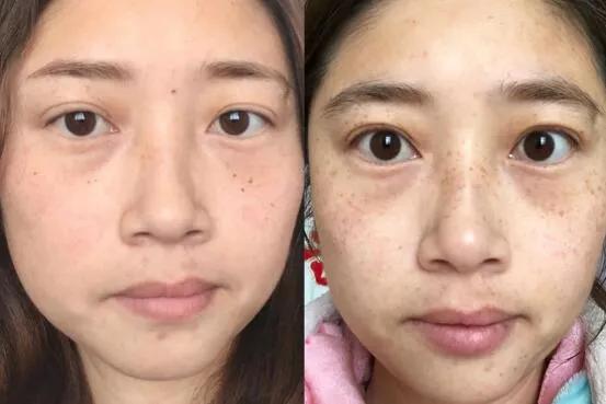 大牌又貴又踩雷!看看這些良心國貨護膚品,祛斑祛痘一點也不差 大牌又貴又踩雷!看看這些良心國貨護膚品,祛斑祛痘一點也不差