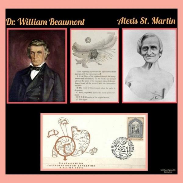 8年完成了238次人體實驗，胃部留洞58年，聖馬丁承受苦難造福人類